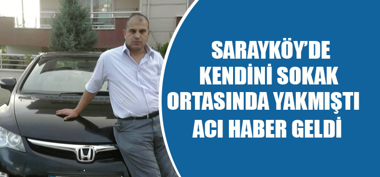 KENDİNİ YAKMIŞTI ACI HABER GELDİ