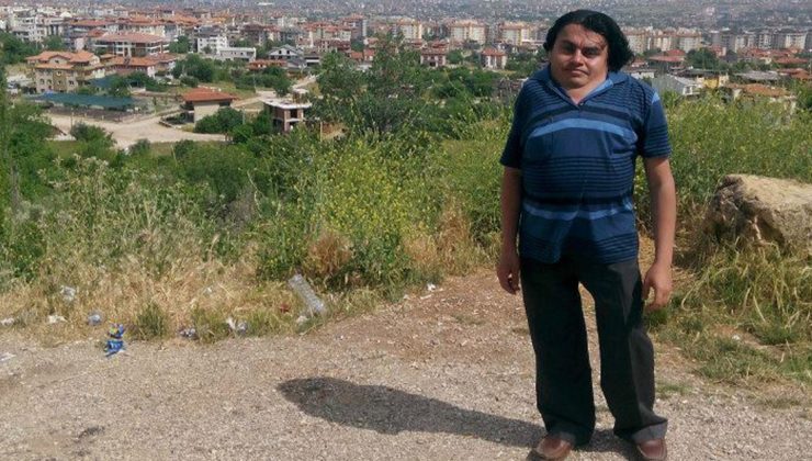 Skolyoz hastası adam genç yaşta hayatını kaybetti!